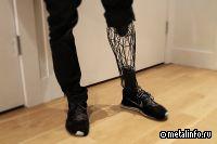 Ростех и АМР организуют производство экзопротезов